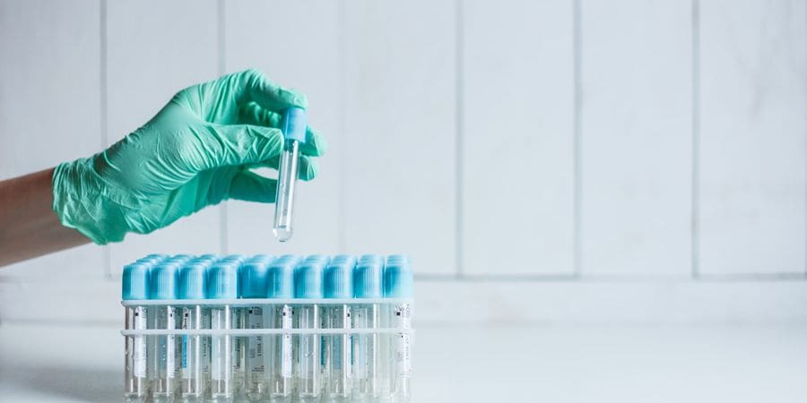 Διάθεση self-test για μαθητές και εμβολιασμένους εκπαιδευτικούς από τα φαρμακεία
